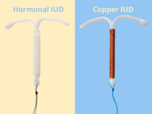 Any Methods of contraception suits ME Top 5 Benefits of a Intrauterine Device