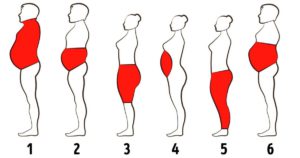 Any Methods of contraception suits ME overweight and pregnancy | conception