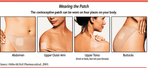 Any Methods of contraception suits ME Birth Control Female adhesive patch